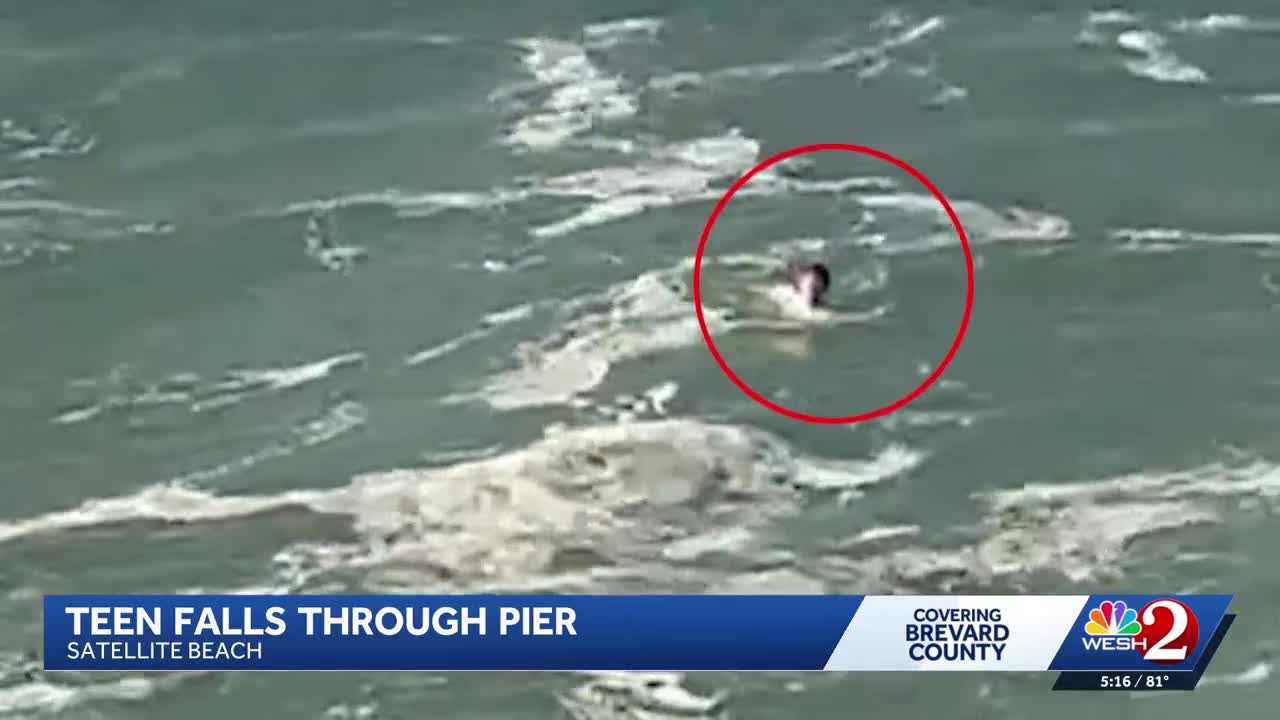 Teenager recovering after a fall through a pier in Florida